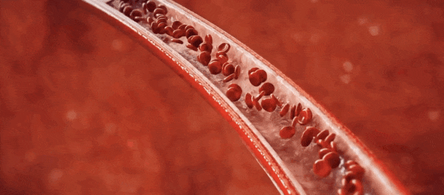 心脑血管疾病有十怕，爱发火的人尤其要当心