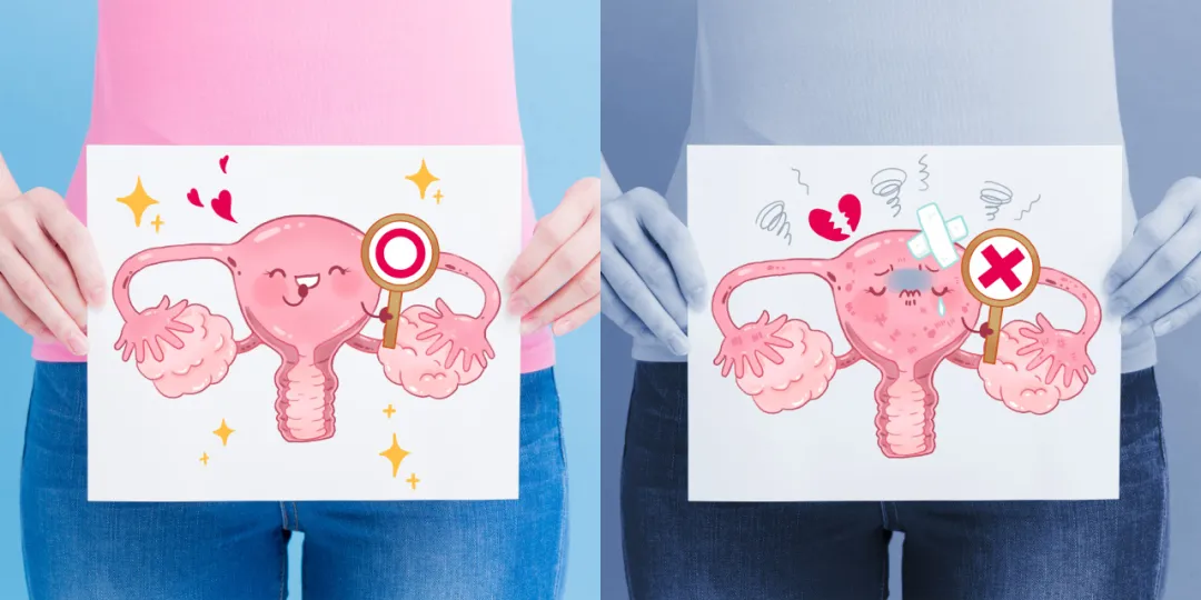 警惕卵巢“断崖式衰老”的6个信号！女性都应该早点知道！