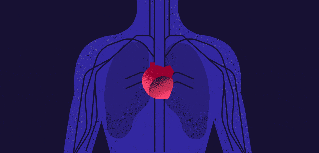 脉搏弱或摸不到，警惕你的血管堵了